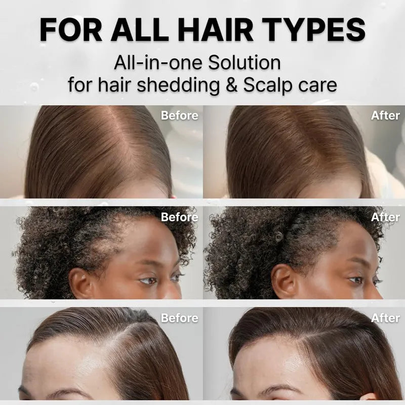 Hair Growth Serum with Massage Brush