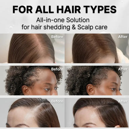 Hair Growth Serum with Massage Brush