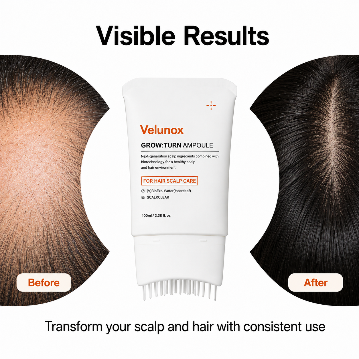 Hair Growth Serum with Massage Brush